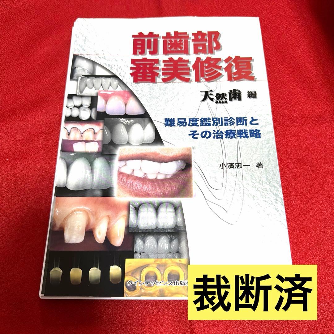 【裁断済】前歯部審美修復 天然歯編