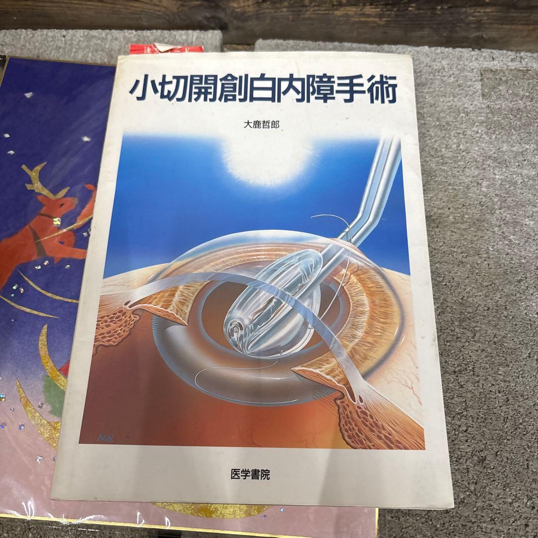 小切開創白内障手術