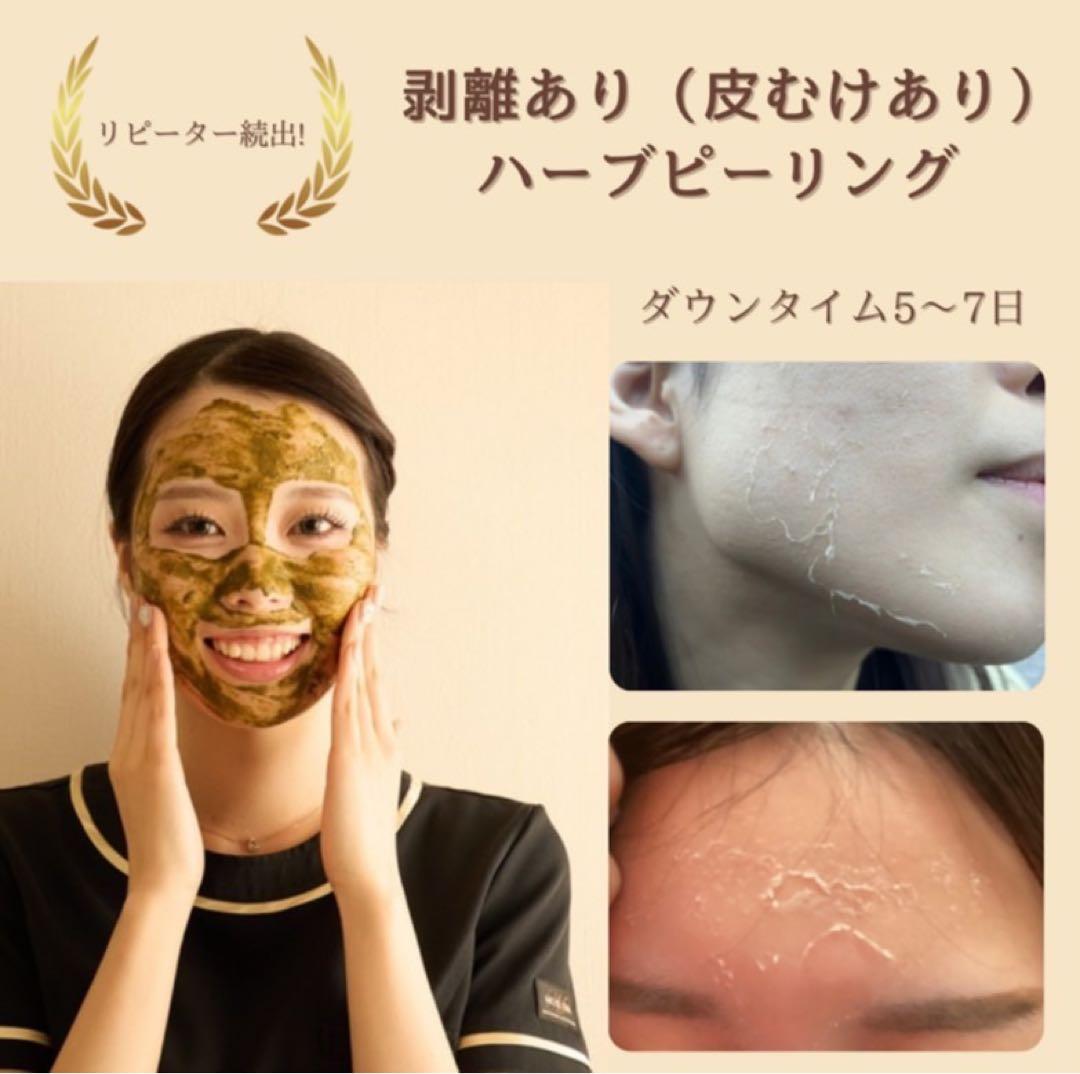 【10個限定】剥離ありハーブピーリング10回分