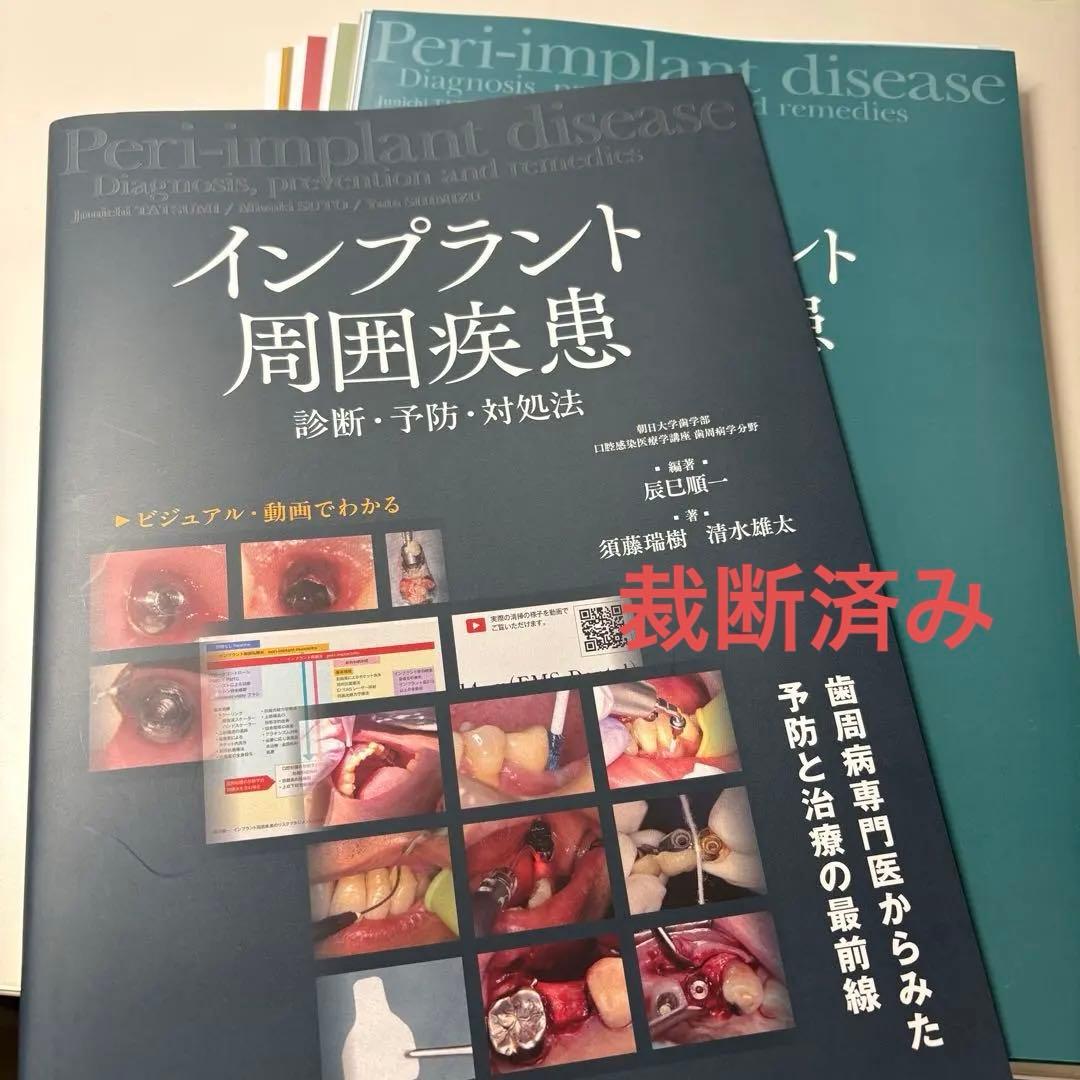 インプラント周囲疾患 診断・予防・対処法 裁断済み