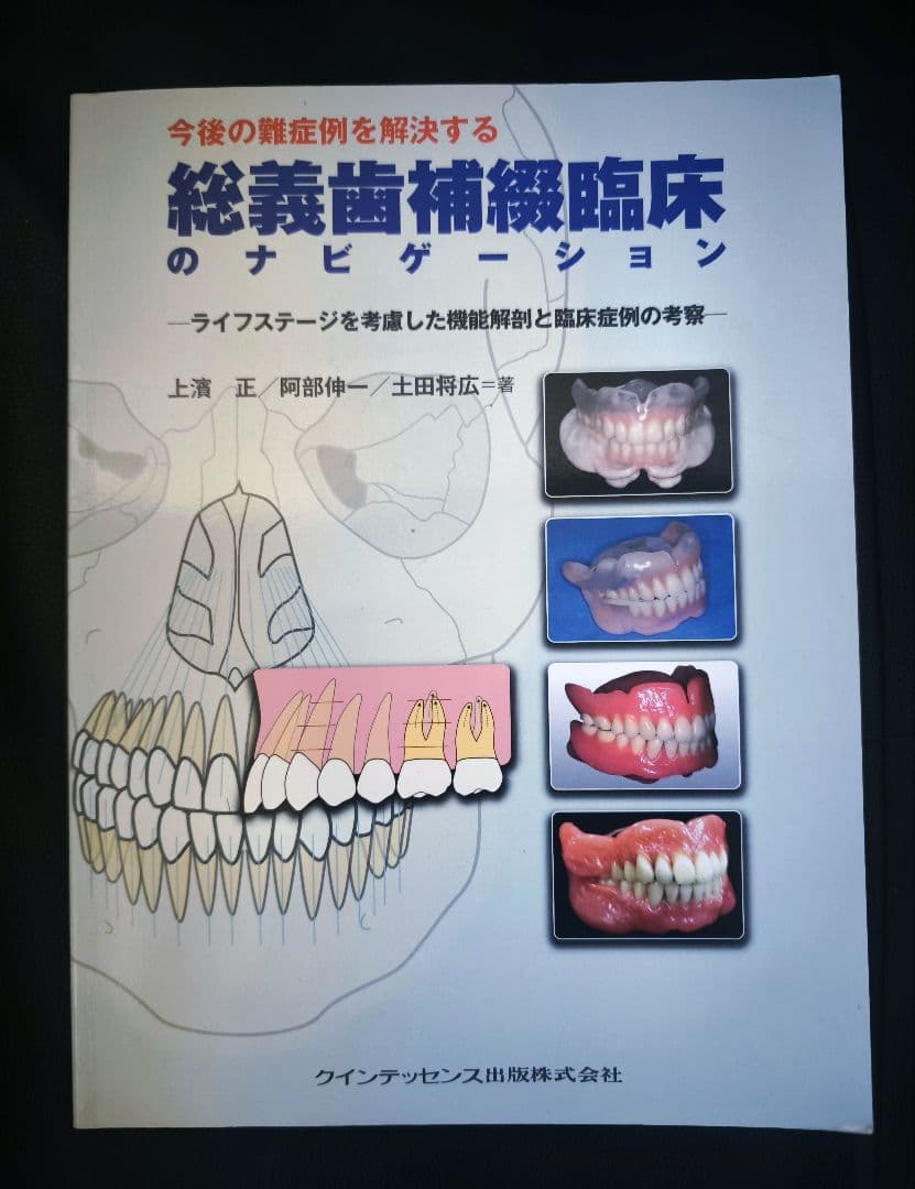 今後の難症例を解決する総義歯補綴臨床のナビゲーション